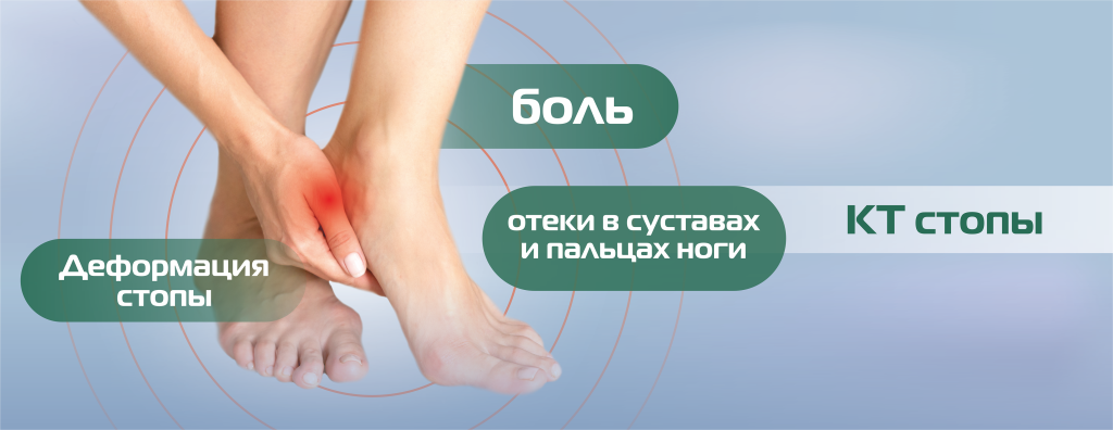 КТ_нижние конечности, стопа.png